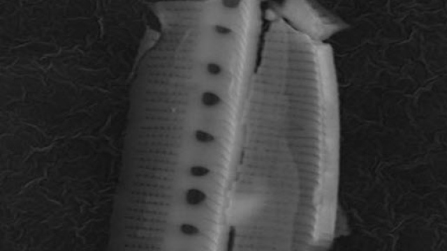 Immagine microscopica di un campione