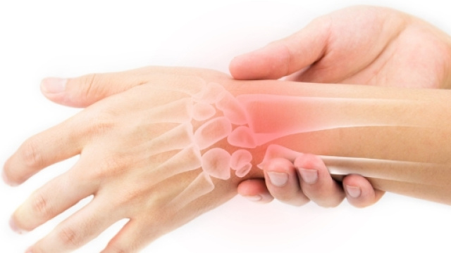 trattamento fisioterapico per l'artrite reumatoide | Pazienti.it - pazienti.it