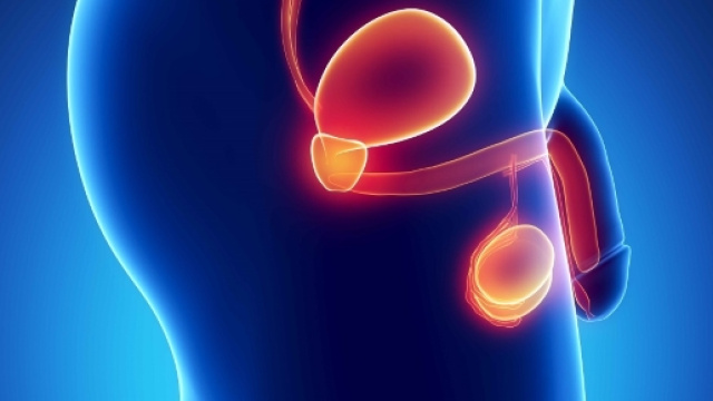 Tumore alla prostata pi&ugrave; aggressivo negli alti e obesi