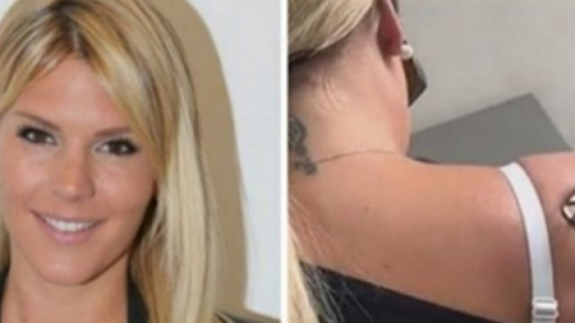 Les Vacances des Anges 2 : Am&eacute;lie Neten se fait retirer ses tatouages au laser et en explique la raison.