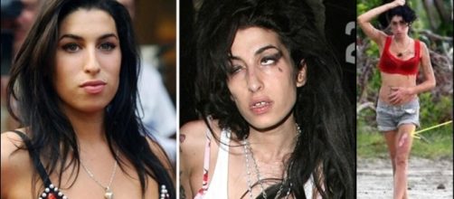 Amy Winehouse antes e depois das drogas.