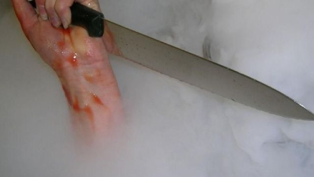 Ha usato un coltellaccio da cucina una furiosa donna indiana per evirare il marito sospettato di tradimento.