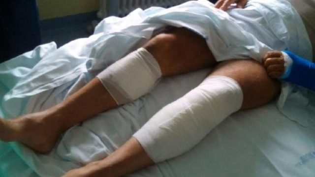 incidenti in montagna. Attacco di un orso nei boschi del trentino (foto - l'adige.it)