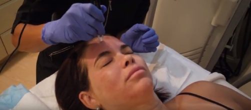 Stimulate collagen growth, improve acne scarring and hyperpigmentation with Microneedling - Image -Rejuven&eacute; | YouTube