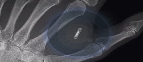 The microchip is implanted between the thumb and the forefinger. Image credit - SignsofThyComing/ouTube.