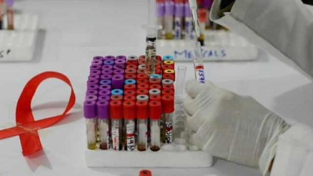 AIDS: cresce la resistenza ai farmaci dell'HIV