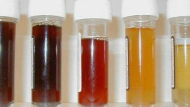 Impariamo a interpretare le urine - Global-Liputan