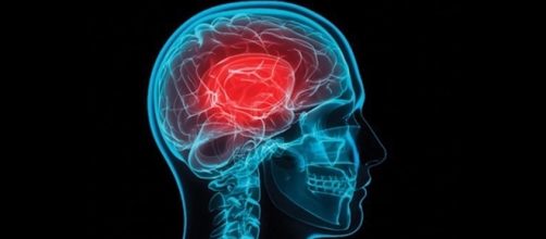 Dr. Heidi Christensen: Concussions from YouTube/CenturaHealth