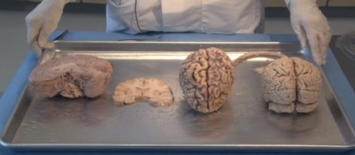 Aging controlled by the hypothalamus - e-channel/YouTube