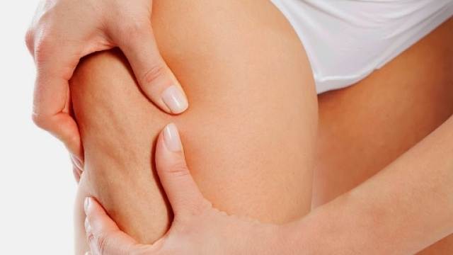 Come eliminare efficacemente la cellulite