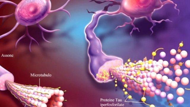 Alzheimer: scoperta la struttura della proteina Tau