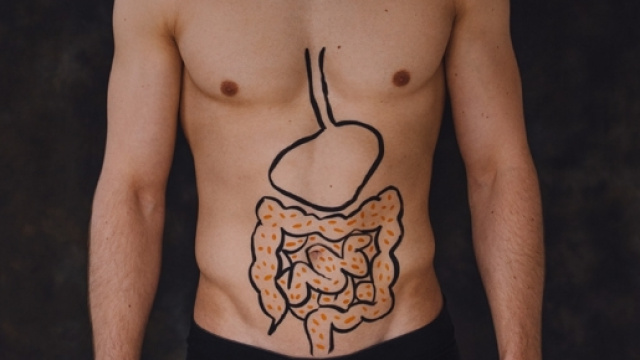 Cancro del colon retto, scoperto meccanismo cellulare correlato ad una dieta ricca di grassi - foto: lauraferrero