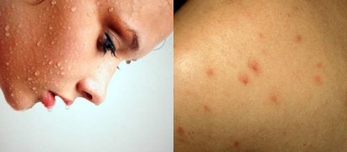 Os sintomas da AIDS incluem perda de peso, febre ou sudorese noturna, fadiga e infec&ccedil;&otilde;es recorrentes.