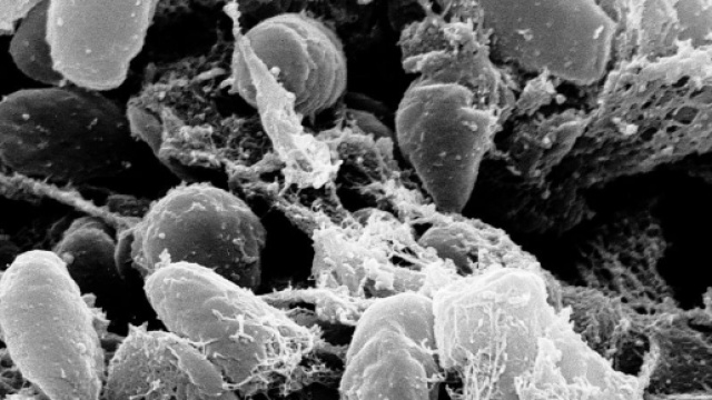 I batteri responsabili della peste in un'immagine al microscopio: c'&egrave; timore negli USA per nuovi casi e pulci infette - Credits: NIAID, NIH