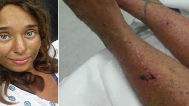 Lisa Theris, 25enne studentessa sopravvissuta nel bosco per 20 giorni