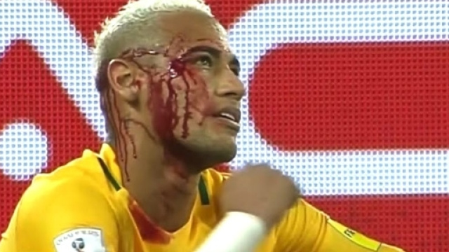 Neymar va devoir se m&eacute;fier des d&eacute;fenses de Ligue 1 pour &eacute;viter les blessures. ( Cr&eacute;dit - DR)