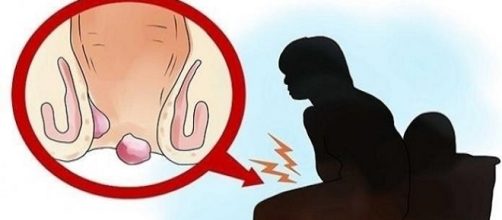 A taxa de cura do vaginismo &eacute; muito alta (Google)