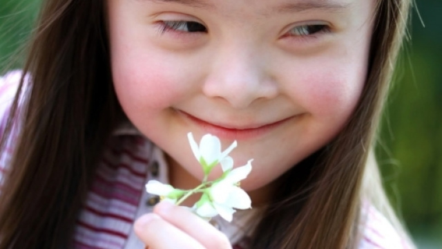 In Islanda stanno scomparendo i bambini con la sindrome di Down