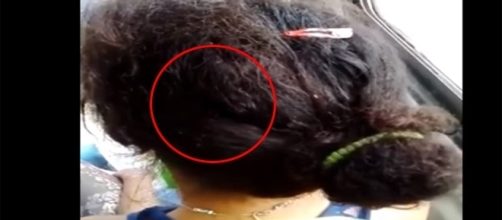 O cabelo dela estava infestado de piolho ( Foto - Reprodu&ccedil;&atilde;o )