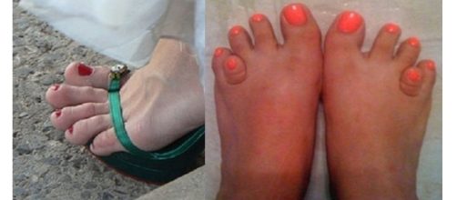 Essas pessoas n&atilde;o devem se orgulhar de seus p&eacute;s ( Foto - Reprodu&ccedil;&atilde;o )