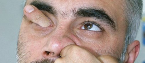 Motivos para nunca mais voc&ecirc; meter o dedo no nariz.