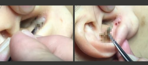 V&iacute;deo impressiona com suposta extra&ccedil;&atilde;o de cravo (Foto: Reprodu&ccedil;&atilde;o)