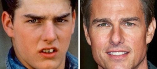 O sorriso faz toda a diferen&ccedil;a no visual de uma pessoa ( Foto - Reprodu&ccedil;&atilde;o )