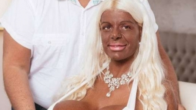 Martina Big ha deciso di cambiare il colore della pelle