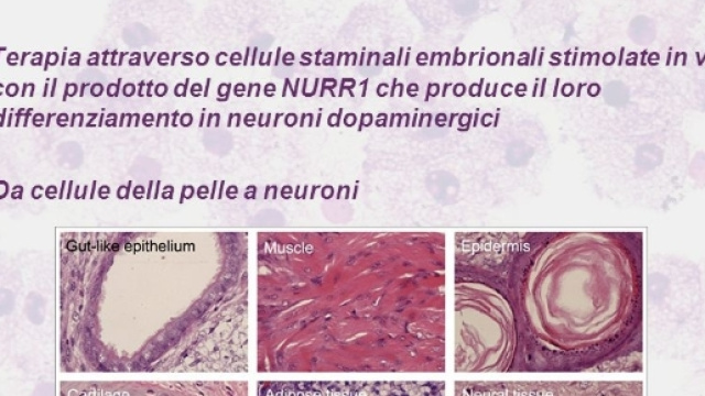 Cellule staminali contro il morbo di Parkinson.