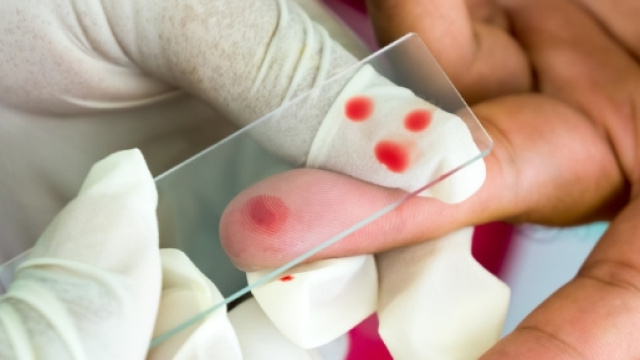 New single-dose malaria treatment could eventually help millions - theconversation.com