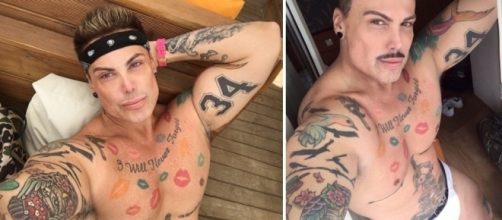 Viciado em cirurgia pl&aacute;stica fica com ere&ccedil;&atilde;o permanente ap&oacute;s nova opera&ccedil;&atilde;o