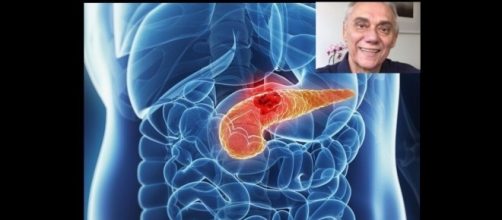 O c&acirc;ncer de p&acirc;ncreas &eacute; um dos mais agressivos