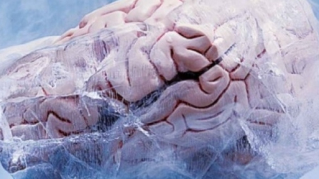 Ibernazione artificiale possibile?