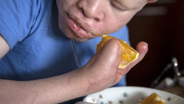 albini-africa-tanzania-persecuzioni-09 - KEBLOG - keblog.it