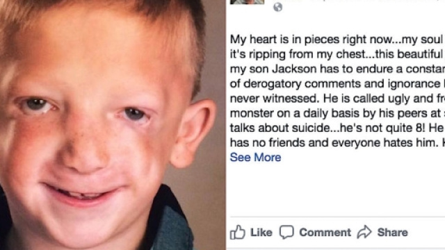 Jackson Bezzant a 8 anni oltraggiato perch&eacute; soffre di una malattia che deforma i lineamenti. Il pap&agrave; ha lanciato un appello su Fb.