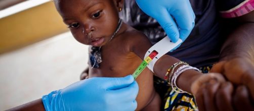 C&oacute;mo se diagnostica la desnutrici&oacute;n infantil? - unicef.es