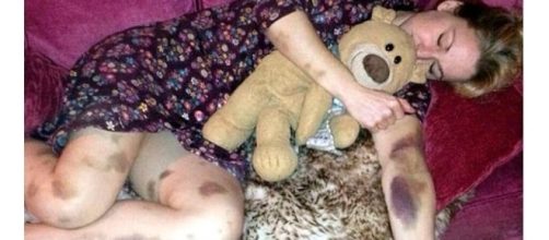 Ela descobriu algo muito s&eacute;rio sobre sua sa&uacute;de ( Foto - Reprodu&ccedil;&atilde;o )