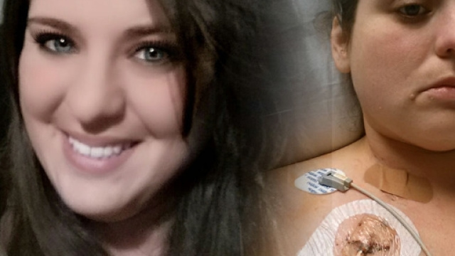 Claressa Coleman prima e dopo il morso del ragno.