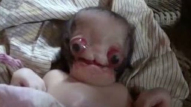 Il bambino nato senza bocca, naso e orecchie