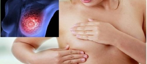 O autoexame detecta anomalias nas mamas