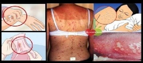 Se voc&ecirc; tem esses sintomas, procure um m&eacute;dico