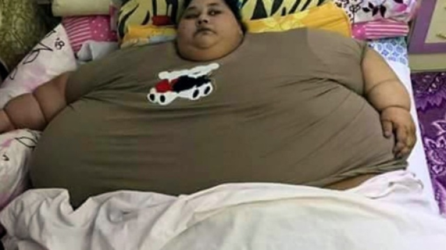 Era la donna pi&ugrave; pesante del mondo, aveva gi&agrave; perso circa 250 kg