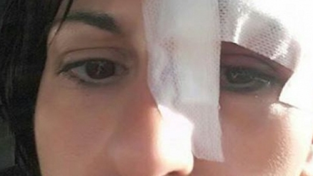 Le ferite riportate da Veronica Nigro: la donna &egrave; caduta per evitare un topo