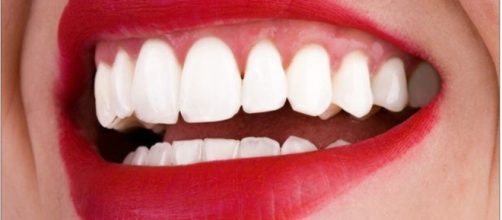 A shiny smile is the best accessory a person can have. - photo by Dr. Kami Hoss via Flickr