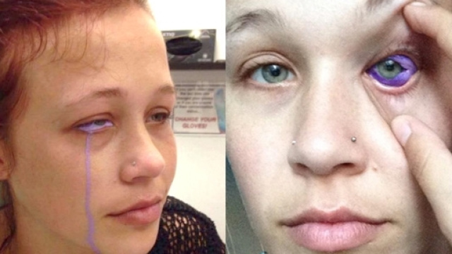 Effetti collaterali di un tatuaggio all'occhio: la modella Catt Gallinger piange lacrime viola e rischia di perdere la vista. Foto: Facebook.