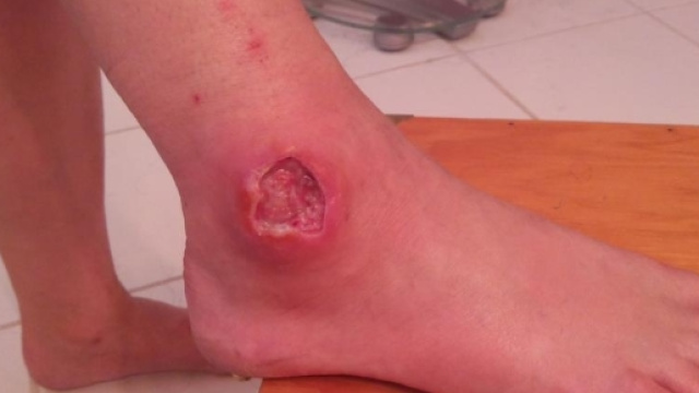 Il ragno violino vive in Italia: &egrave; pericoloso per il suo veleno - notiziesecche.it