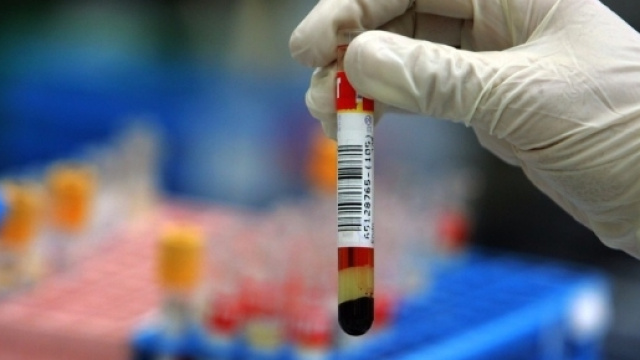 Alcol test: la Cassazione rivoluziona la validit&agrave; delle analisi in ospedale