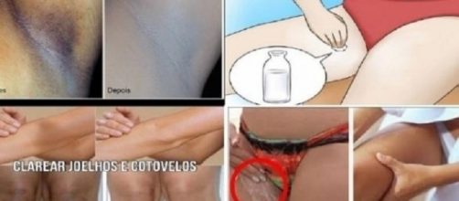 Dicas caseiras para auxiliar no clareamento da pele