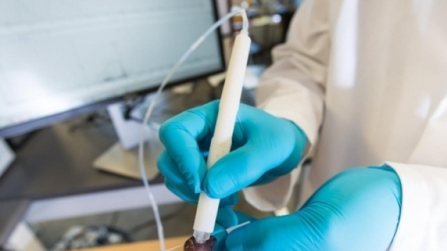 Mas Spec, la penna che identifica il cancro