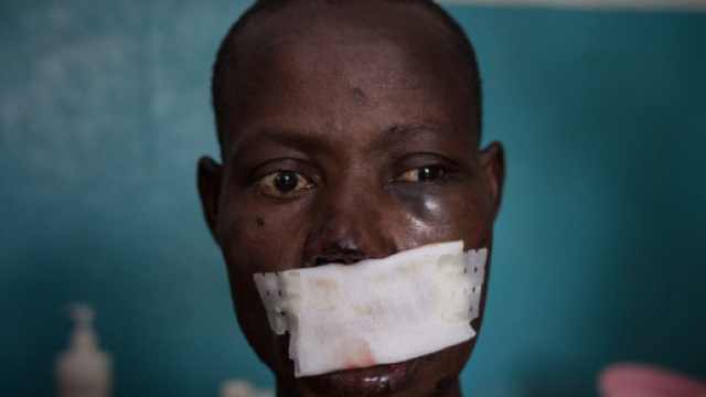 L&eacute;onard Gangbe, 33 anni, agricoltore, uomini armati gli hanno sparato alla testa. - Foto da Msf